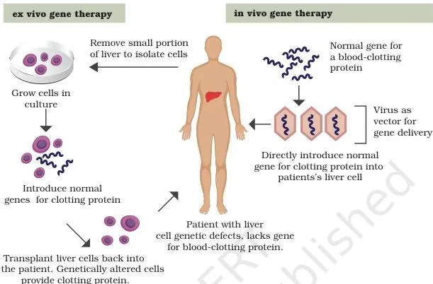 Applications of Recombinant DNA Technology Class 12 PDF Two mirrored routes of gene therapy, one drawing cells out of the patient, modifying them and returning them, the other delivering genes directly into the body