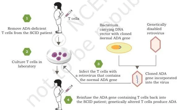 Applications of Recombinant DNA Technology Class 12 PDF Closed-loop diagram of SCID gene therapy showing lymphocytes collected from the patient, the ADA gene delivered by a viral vector, and the corrected cells returned to the bloodstream
