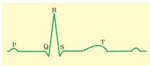Body Fluids and Circulation Class 11: NCERT Chapter 15 PDF Standard ECG trace on a grid with a flat baseline, showing the small P wave, the sharp QRS complex and the T wave that follows each heartbeat