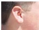 Heredity Class 10: NCERT Science Chapter 8 PDF Explained Two ears side by side, one with a free earlobe hanging below the attachment point and one with an attached earlobe fused to the side of the head, showing two inherited variants of one human trait