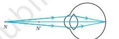 Diagram showing the receded near point of a hypermetropic eye at 1 metre, which is farther than the normal 25 cm near point