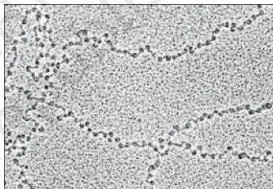 Molecular Basis of Inheritance Class 12 PDF (NCERT Chapter 5) Electron micrograph of chromatin showing a beads-on-string arrangement of nucleosomes linked along the DNA