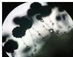 Diversity and Classification Class 9 Notes: Five Kingdoms Microscopic view of yeast cells, a unicellular fungus whose chitin cell wall places it in Kingdom Fungi