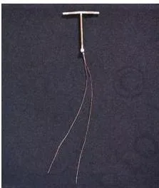 T-shaped copper-releasing intrauterine device held in the uterus, where copper ions suppress sperm motility and fertilising capacity