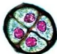 Pollen grains of many species cause severe allergies and bronchial afflictions in some people often leading to chronic respiratory disorders – asthma, bronchitis, etc.
